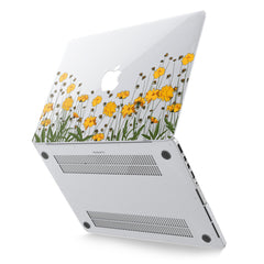 Lex Altern Hard Plastic MacBook Case Yellow Flowers