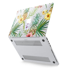 Lex Altern Hard Plastic MacBook Case Hawaiian Print