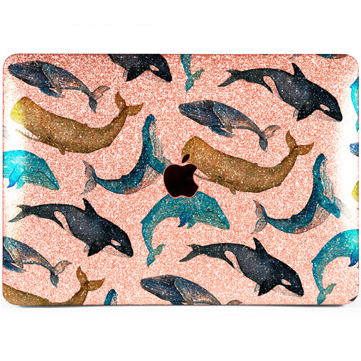 Lex Altern MacBook Glitter Case Whale Pattern