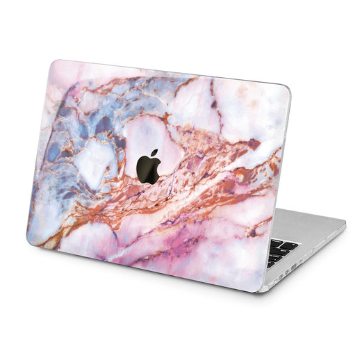 Lex Altern Lex Altern Classy Colored Marble Case for your Laptop Apple Macbook.