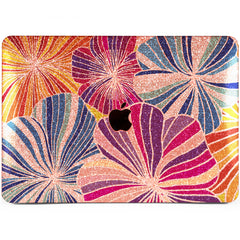 Lex Altern MacBook Glitter Case Striped Flowers