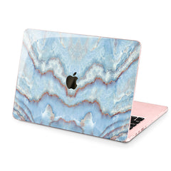 Lex Altern Hard Plastic MacBook Case Light Blue Texture