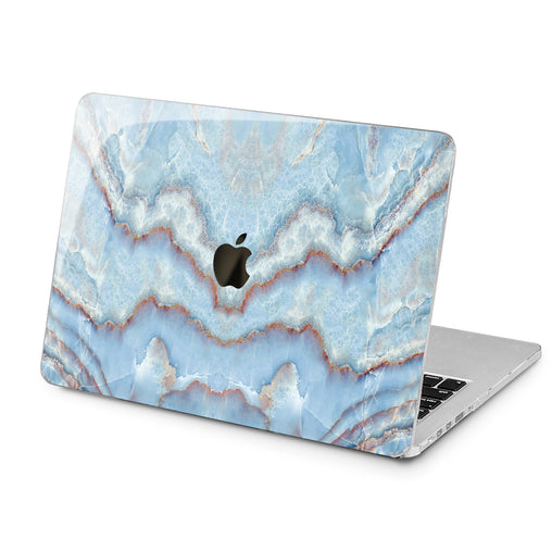 Lex Altern Lex Altern Light Blue Texture Case for your Laptop Apple Macbook.