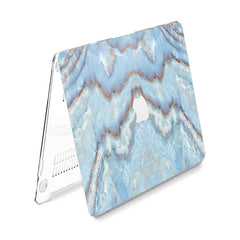 Lex Altern Hard Plastic MacBook Case Light Blue Texture