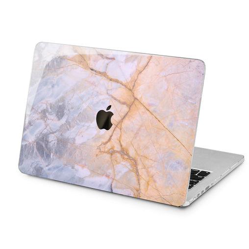 Lex Altern Lex Altern Pink Rock Case for your Laptop Apple Macbook.