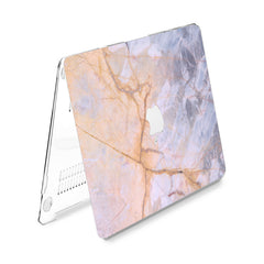 Lex Altern Hard Plastic MacBook Case Pink Rock