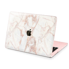 Lex Altern Hard Plastic MacBook Case Tender Pink Print