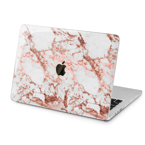Lex Altern Lex Altern Abstract Marble Case for your Laptop Apple Macbook.