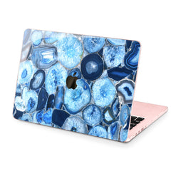 Lex Altern Hard Plastic MacBook Case Onyx Blue Agate