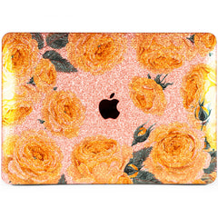 Lex Altern MacBook Glitter Case Yellow Roses