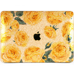 Lex Altern MacBook Glitter Case Yellow Roses