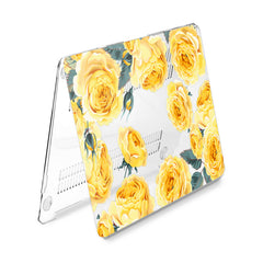 Lex Altern Hard Plastic MacBook Case Yellow Roses