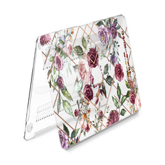 Lex Altern Hard Plastic MacBook Case Floral Abstract