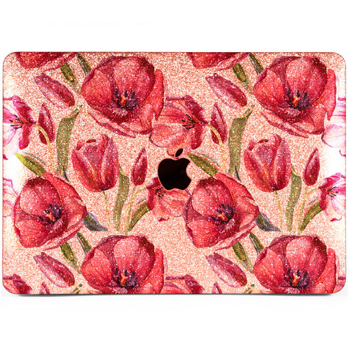 Lex Altern MacBook Glitter Case Red Tulips