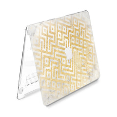 Lex Altern Hard Plastic MacBook Case Golden Pattern