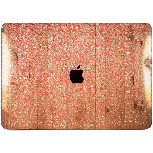 Lex Altern MacBook Glitter Case Wood Pattern