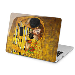 Lex Altern Lex Altern The Kiss Case for your Laptop Apple Macbook.