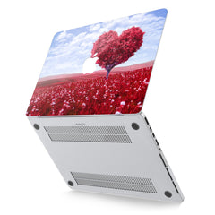 Lex Altern Hard Plastic MacBook Case Love Field