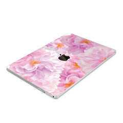 Lex Altern Hard Plastic MacBook Case Pink Blossom