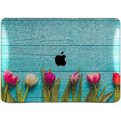 Lex Altern MacBook Glitter Case Tulip Design