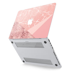 Lex Altern Hard Plastic MacBook Case Pink Marble
