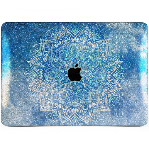 Lex Altern MacBook Glitter Case Blue Sky