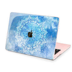 Lex Altern Hard Plastic MacBook Case Blue Sky
