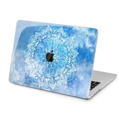 Lex Altern Lex Altern Blue Sky Case for your Laptop Apple Macbook.