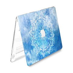 Lex Altern Hard Plastic MacBook Case Blue Sky