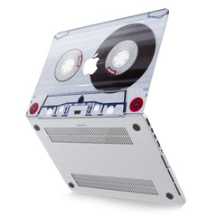 Lex Altern Hard Plastic MacBook Case White Cassette