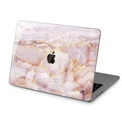 Lex Altern Hard Plastic MacBook Case Pink Marble Design
