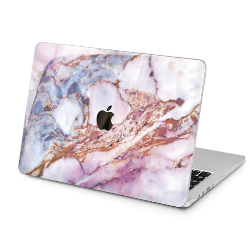 Lex Altern Colored Marble Design Case for your Laptop Apple Macbook.
