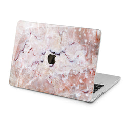 Lex Altern Pink Marble Art Case for your Laptop Apple Macbook.