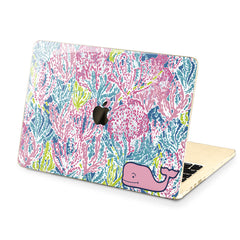 Lex Altern Hard Plastic MacBook Case Cute Pink Whale