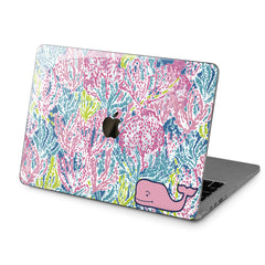 Lex Altern Hard Plastic MacBook Case Cute Pink Whale