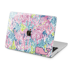 Lex Altern Cute Pink Whale Case for your Laptop Apple Macbook.