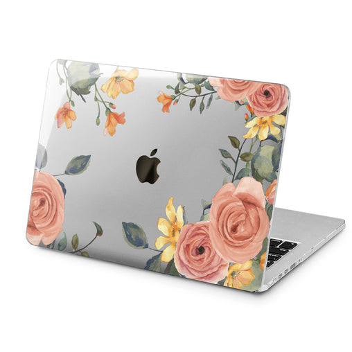Lex Altern Orange Roses Art Case for your Laptop Apple Macbook.