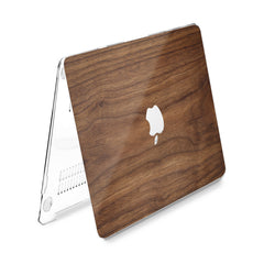 Lex Altern Hard Plastic MacBook Case Walnuts Pattern