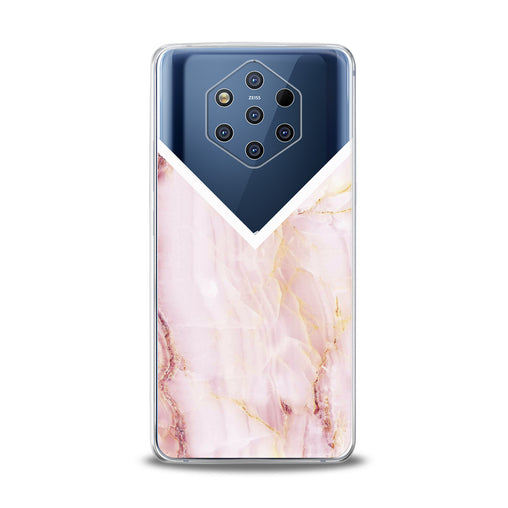 Lex Altern Pink Marble Nokia Case