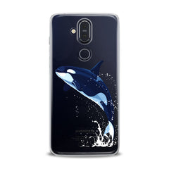 Lex Altern TPU Silicone Nokia Case Cute Whale